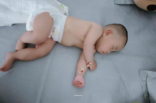 鹿邑宝宝褶皱处擦粉还是油